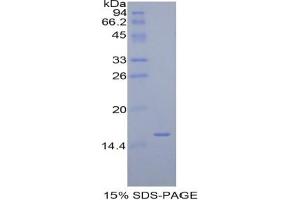 SDS-PAGE analysis of Human Diamine Oxidase Protein. (DAO Protein)