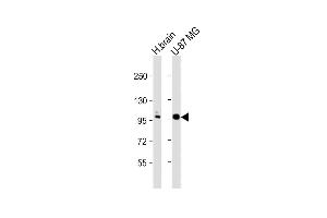 All lanes : Anti-ANO5 Antibody (C-term) at 1:1000 dilution Lane 1: human brain lysate Lane 2: U-87 MG whole cell lysate Lysates/proteins at 20 μg per lane. (Anoctamin 5 Antikörper  (C-Term))