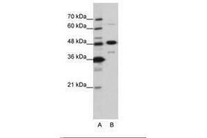 Image no. 2 for anti-Nucleolar Protein 4 (NOL4) (AA 239-288) antibody (ABIN6736202) (NOL4 Antikörper  (AA 239-288))