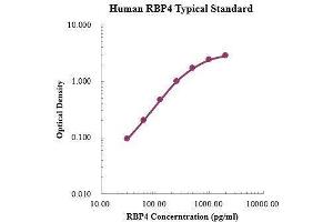 ELISA image for Retinol Binding Protein 4, Plasma (RBP4) ELISA Kit (ABIN3198609) (RBP4 ELISA Kit)