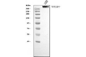 Western blot analysis of 53BP1/TP53BP1 using anti-53BP1/TP53BP1 antibody (ABIN7599869). (TP53BP1 Antikörper  (AA 1239-1972))