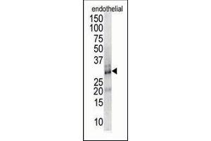Antibody is used in Western blot to detect DSCR1 in endothelial cell lysate. (RCAN1 Antikörper  (AA 75-104))