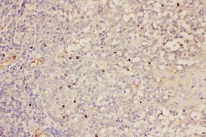 Anti-FOXP3 Picoband antibody,  IHC(P): Human Tonsil Tissue