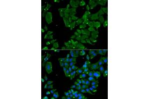 Immunofluorescence analysis of HeLa cells using DBN1 antibody (ABIN6129572, ABIN6139424, ABIN6139425 and ABIN6221983). (DBN1 Antikörper  (AA 350-649))