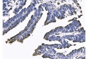 IHC analysis of SUN2 using anti-SUN2 antibody (ABIN7601278).