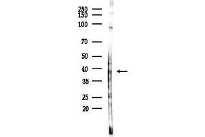 anti-Growth Differentiation Factor 1 (GDF1) (N-Term) antibody