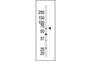 Western Blotting (WB) image for anti-Chromobox Homolog 4 (CBX4) (N-Term) antibody (ABIN357750) (CBX4 Antikörper  (N-Term))