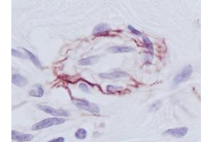 Image no. 1 for anti-PDGF-BB Homodimer antibody (ABIN465589) (PDGF-BB Homodimer Antikörper)