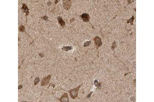ABIN6277923 at 1/50 staining human brain tissue sections by IHC-P. (PINK1 Antikörper)
