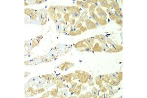 Immunohistochemistry of paraffin-embedded mouse heart using TBXAS1 antibody (ABIN6293260) at dilution of 1:100 (40x lens). (TBXAS1 Antikörper)