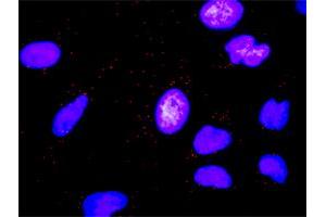 Proximity Ligation Analysis of protein-protein interactions between MMP7 and FASLG. (FASL Antikörper  (AA 1-281))