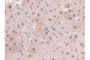 DAB staining on IHC-P; Samples: Human Liver Tissue (HFE2 Antikörper  (AA 234-416))