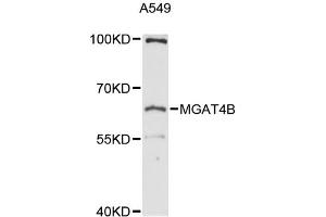 Western blot analysis of extracts of A-549 cells, using MGAT4B antibody (ABIN6292737) at 1:3000 dilution.
