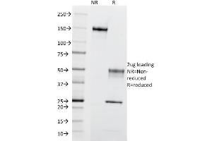 SDS-PAGE Analysis of Purified CD195 Mouse Monoclonal Antibody (12D1). (CCR5 Antikörper)