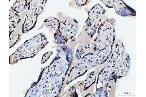 IHC analysis of C1orf77/FOP/CHTOP using anti-C1orf77/FOP/CHTOP antibody (ABIN7603201). (CHTOP Antikörper  (N-Term))