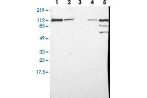 Western blot analysis of Lane 1: RT-4, Lane 2: U-251 MG, Lane 3: Human Plasma, Lane 4: Liver, Lane 5: Tonsil with MVP polyclonal antibody (PAB28550) at 1:250-1:500 dilution. (MVP Antikörper)