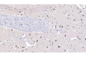Detection of NT3 in Human Cerebrum Tissue using Polyclonal Antibody to Neurotrophin 3 (NT3)