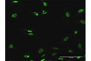 Immunofluorescence of purified MaxPab antibody to ABHD11 on HeLa cell. (ABHD11 Antikörper  (AA 1-315))