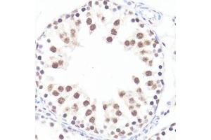 Immunohistochemistry of paraffin-embedded rat testis using P-MYC-S62 antibody (ABIN3019544, ABIN3019545, ABIN3019546 and ABIN6225456) at dilution of 1:100 (40x lens). (c-MYC Antikörper  (pSer62))