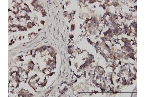 Image no. 1 for anti-Fragile X Mental Retardation, Autosomal Homolog 1 (FXR1) (AA 121-220) antibody (ABIN599029) (FXR1 Antikörper  (AA 121-220))