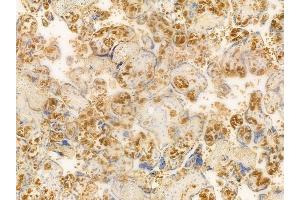 ABIN6261735 and ABIN6266539 at 1/100 staining human normal placenta tissue by IHC-P. (FGFR2 Antikörper  (C-Term))