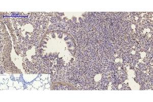 Immunohistochemistry of paraffin-embedded Rat lung tissue using α-SMA Polyclonal Antibody at dilution of 1:200. (alpha-SMA Antikörper)