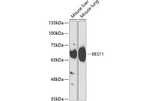 Western blot analysis of extracts of various cell lines, using BEST1 antibody (ABIN6127515, ABIN6137534, ABIN6137536 and ABIN6218300) at 1:1000 dilution. (Bestrophin 1 Antikörper  (AA 376-585))