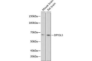 Western blot analysis of extracts of various cell lines, using DPYSL3 Polyclonal Antibody (ABIN6130137, ABIN6139811, ABIN6139812 and ABIN6215891) at 1:1000 dilution. (DPYSL3 Antikörper  (AA 1-280))