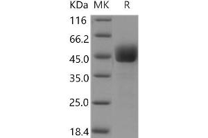 Western Blotting (WB) image for CD3d Molecule, delta (CD3-TCR Complex) (CD3D) protein (Fc Tag) (ABIN7320294) (CD3D Protein (Fc Tag))