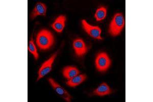 Immunofluorescent analysis of APOA1BP staining in HEK293T cells. (APOA1BP Antikörper  (Center))
