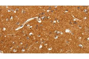 Immunohistochemistry (Paraffin-embedded Sections) (IHC (p)) image for anti-Solute Carrier Family 4, Sodium Bicarbonate Cotransporter, Member 4 (SLC4A4) antibody (ABIN7235532)