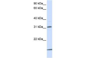 WB Suggested Anti-SLC25A11 Antibody Titration:  0. (SLC25A11 Antikörper  (N-Term))