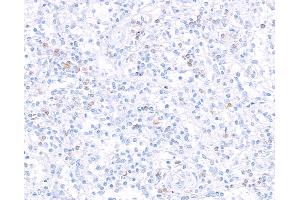 Immunohistochemistry (IHC) image for anti-Interleukin 7 Receptor (IL7R) (AA 21-236) antibody (ABIN7453897) (Rekombinanter IL7R Antikörper  (AA 21-236))
