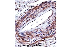 Immunohistochemistry (Paraffin-embedded Sections) (IHC (p)) image for anti-Purinergic Receptor P2X, Ligand-Gated Ion Channel, 5 (P2RX5) (AA 325-353), (C-Term) antibody (ABIN657980)