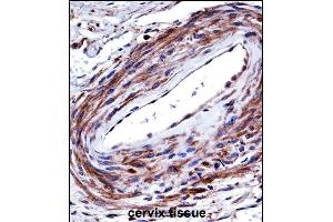 P2RX5 Antibody (C-term) ((ABIN657980 and ABIN2846926))immunohistochemistry analysis in formalin fixed and paraffin embedded human cervix tissue followed by peroxidase conjugation of the secondary antibody and DAB staining. (P2RX5 Antikörper  (C-Term))