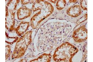 IHC image of ABIN7149158 diluted at 1:400 and staining in paraffin-embedded human kidney tissue performed on a Leica BondTM system.