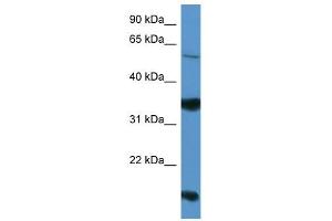 Western Blot showing NTNG2 antibody used at a concentration of 1-2 ug/ml to detect its target protein. (Netrin G2 Antikörper  (Middle Region))