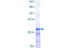 TKTL2 Protein (AA 59-120) (GST tag)