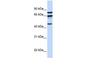WB Suggested Anti-PPP4R2 Antibody Titration:  0. (PPP4R2 Antikörper  (C-Term))