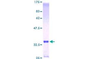 Image no. 1 for Metallothionein 1E (MT1E) (AA 1-61) protein (GST tag) (ABIN1311497) (MT1E Protein (AA 1-61) (GST tag))