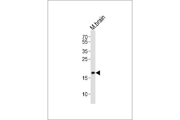FAM168B antibody  (C-Term)