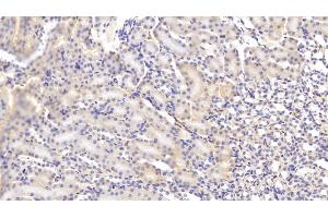 Immunohistochemistry (IHC) image for anti-Complement Component C4b (C4b) (AA 126-366) antibody (ABIN7433423)