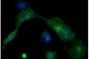 Image no. 3 for anti-Melan A (MLANA) antibody (ABIN1499426) (MLANA Antikörper)