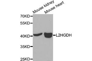 Western blot analysis of extracts of various cell lines, using L2HGDH antibody (ABIN5975242) at 1/1000 dilution. (L2HGDH Antikörper)