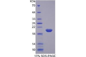 SDS-PAGE (SDS) image for Arginyl-tRNA Synthetase (RARS) ELISA Kit (ABIN6720500)
