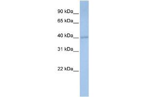 WB Suggested Anti-PDSS1 Antibody Titration:  0. (PDSS1 Antikörper  (Middle Region))