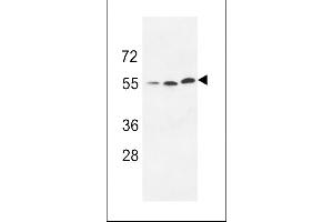 Western blot analysis of anti-URKL1 Pab (ABIN391288 and ABIN2841330) in 293 cell line lysate (35 μg/lane).