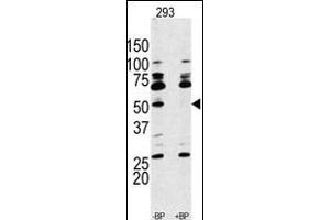 Western blot analysis of anti-RPS6KB1 Antibody (Center) Pab (ABIN389685 and ABIN2839654) pre-incubated with and without blocking peptide (BPNULL) in 293 cell line lysate. (RPS6KB1 Antikörper  (AA 277-306))