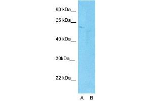 Host:  Rabbit  Target Name:  YAP1  Sample Type:  Human Fetal Lung cell  Lane A:  Primary Antibody  Lane B:  Primary Antibody + Blocking Peptide  Primary Antibody Concentration:  1ug/ml  Peptide Concentration:  5. (YAP1 Antikörper  (C-Term))