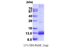 SDS-PAGE (SDS) image for Peptidase Inhibitor 3, Skin-Derived (PI3) (AA 23-117) protein (His tag) (ABIN5854272) (PI3 Protein (AA 23-117) (His tag))